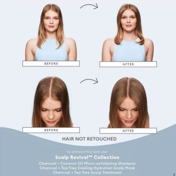 $7 🌙 Briogeo Scalp Revival Micro Exfoliating Shampoo NEW‎ - Picture 8 of 10